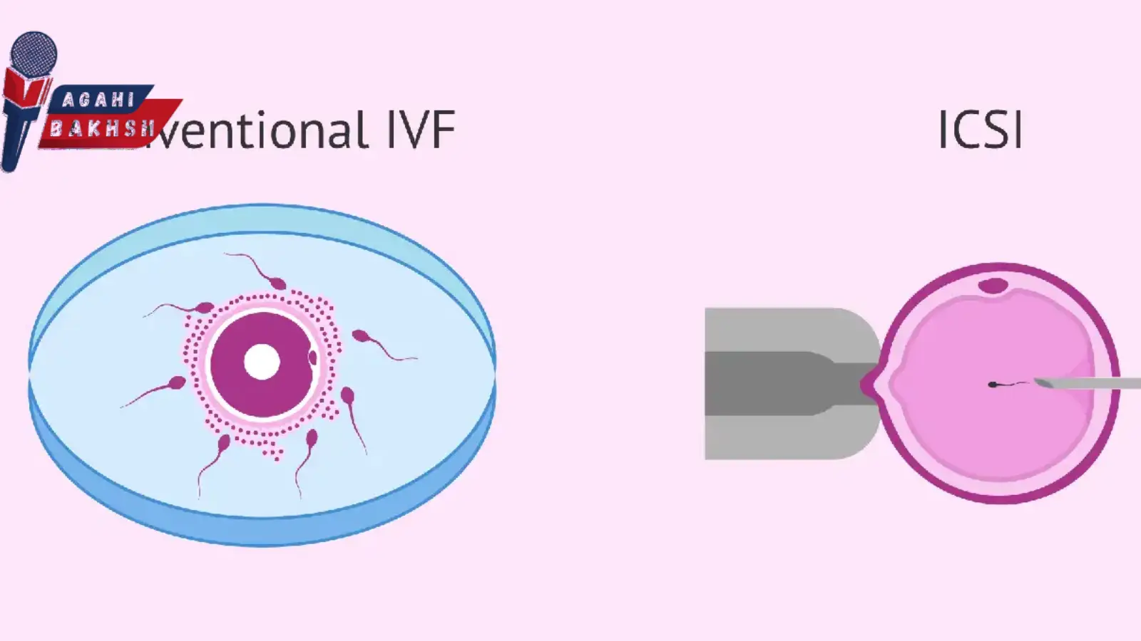 آینده IVF گامتو