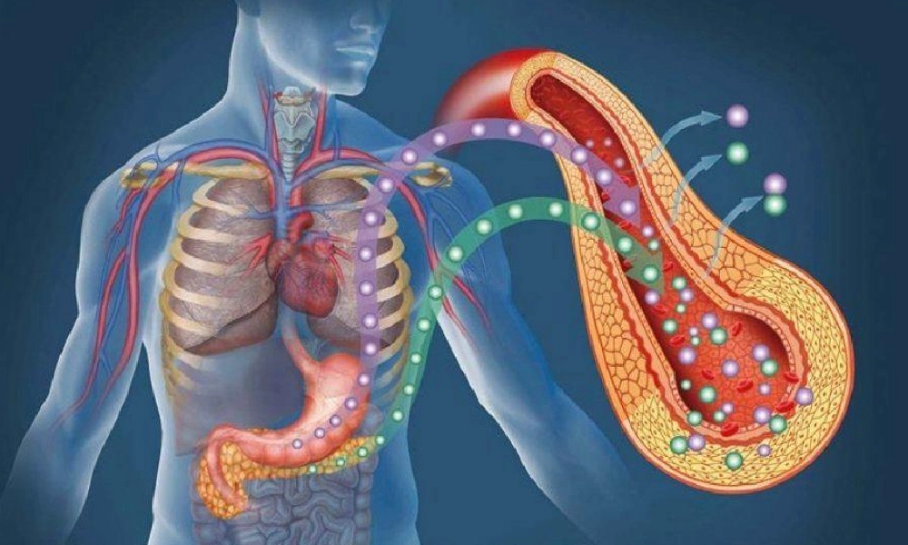 دیابت نوع ۲