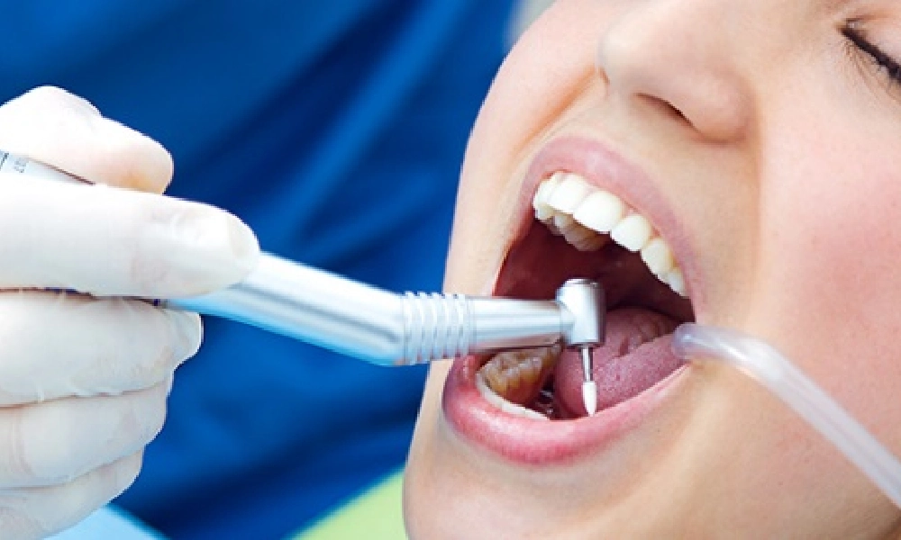 بیمه تکمیلی