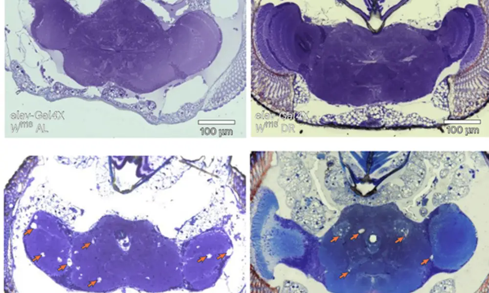نقش قند موجود در مغز