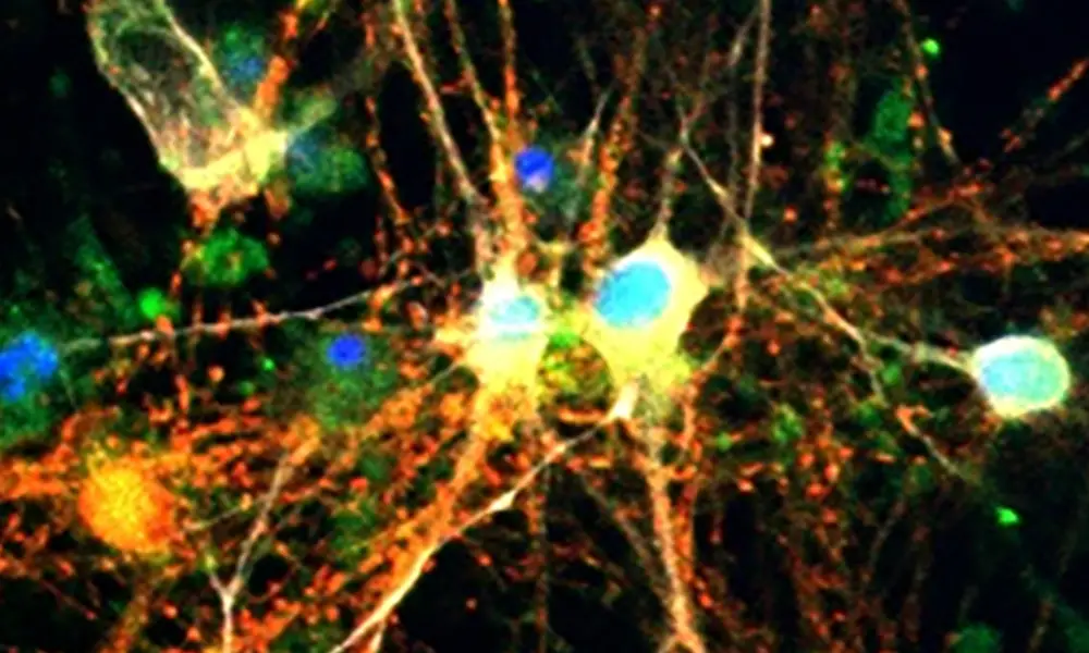 نقش قند موجود در مغز