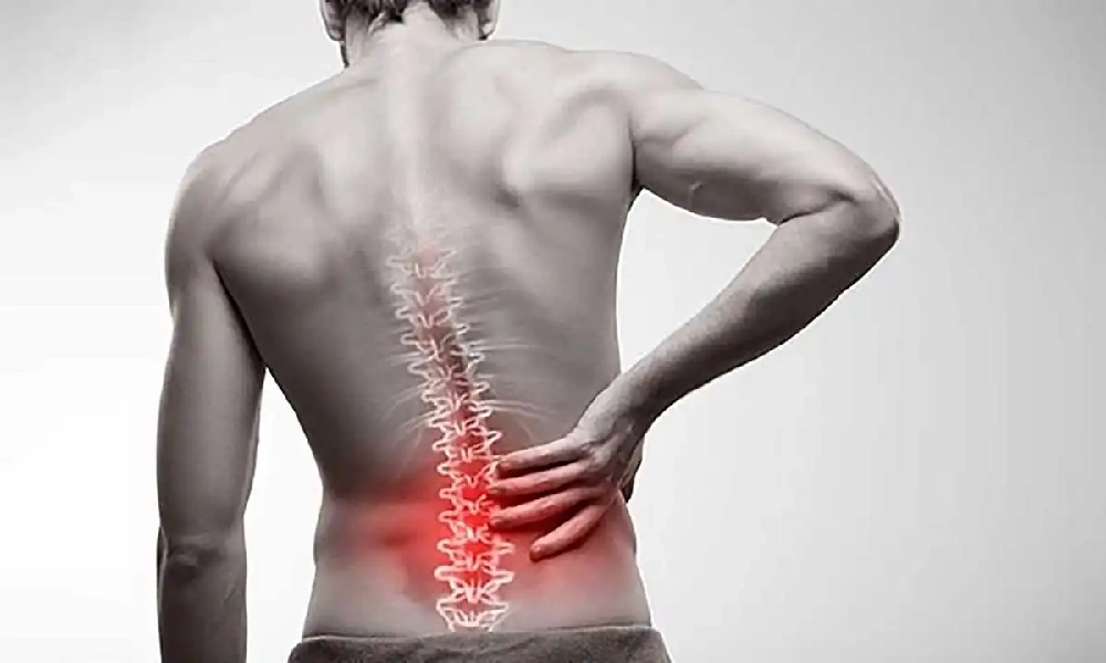 تزریق اوزون برای کمردرد